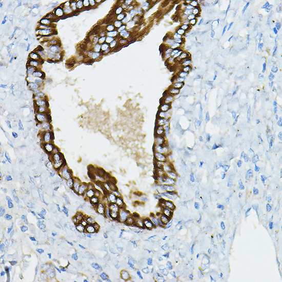 IRAK4 Rabbit polyclonal antibody