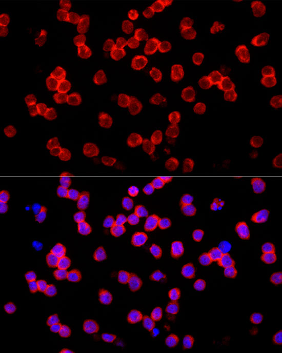 IL22 Rabbit polyclonal antibody