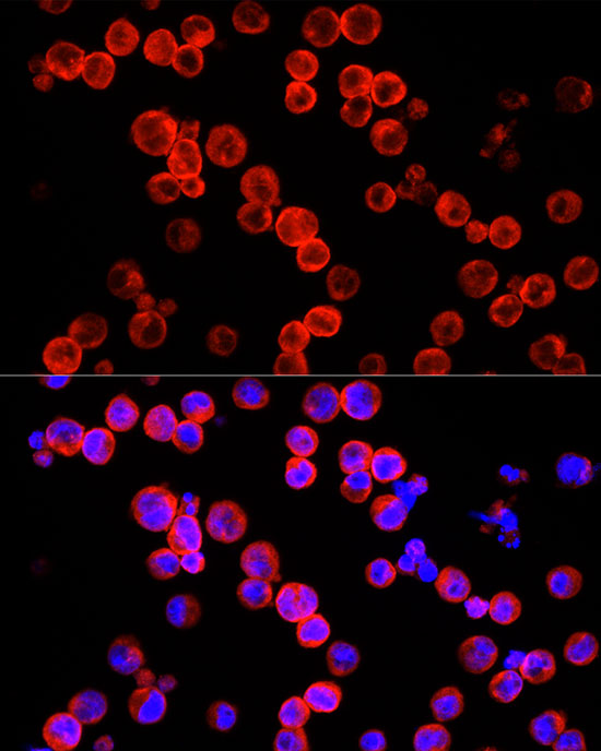 IL22 Rabbit polyclonal antibody