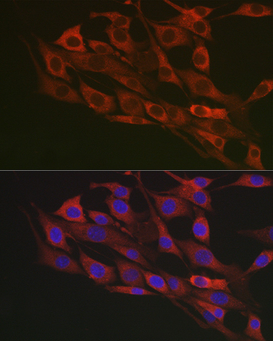 [KO Validated] Flotillin 1 Rabbit polyclonal antibody