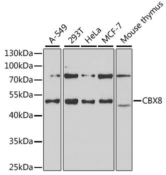 CBX8 Rabbit polyclonal antibody