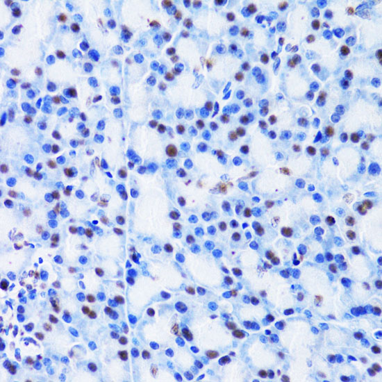 CBX8 Rabbit polyclonal antibody