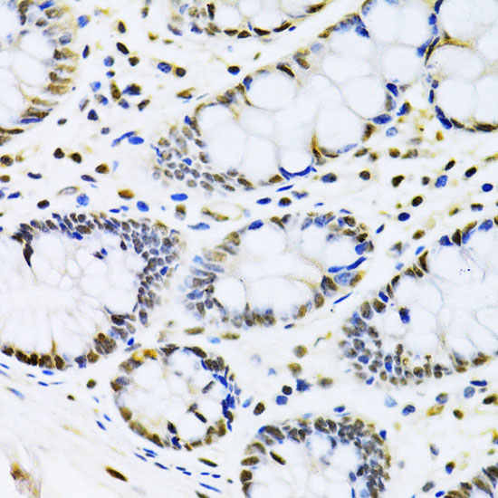 CBX8 Rabbit polyclonal antibody