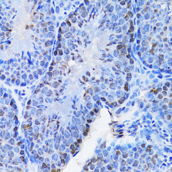 CBX8 Rabbit polyclonal antibody