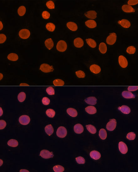 TADA3 Rabbit polyclonal antibody