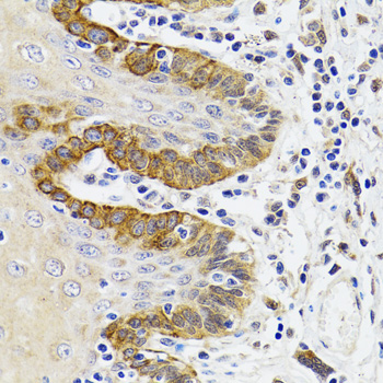 ESD Rabbit polyclonal antibody