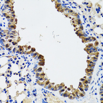 ESD Rabbit polyclonal antibody