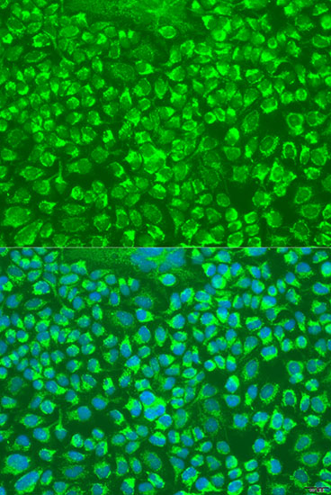 GZMA Rabbit polyclonal antibody