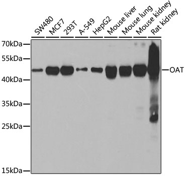 OAT Rabbit polyclonal antibody