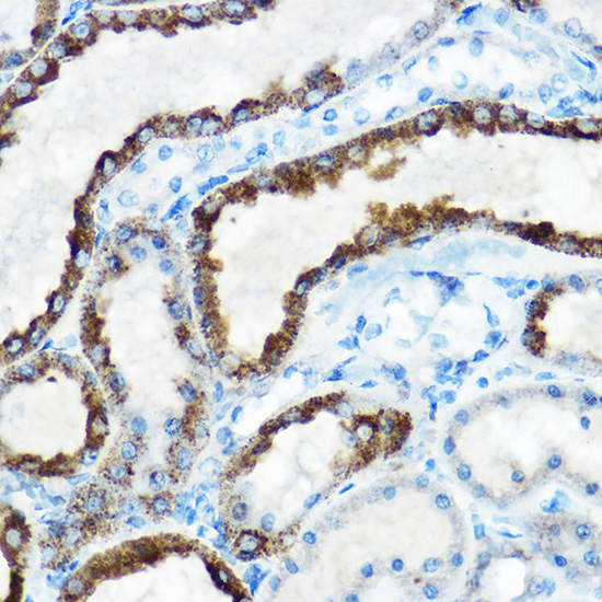 OAT Rabbit polyclonal antibody