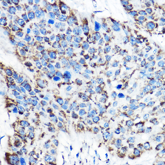 OAT Rabbit polyclonal antibody
