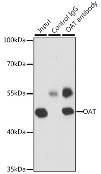 OAT Rabbit polyclonal antibody