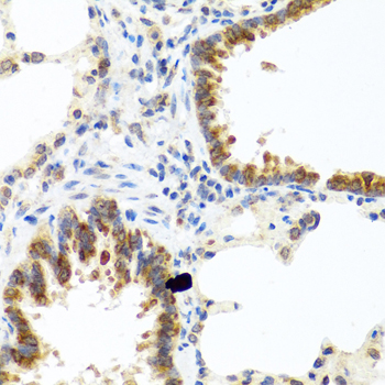 C8orf4 Rabbit polyclonal antibody