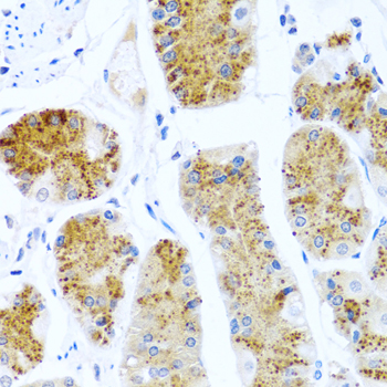 C8orf4 Rabbit polyclonal antibody