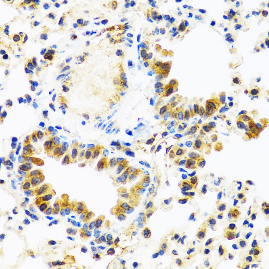 C8orf4 Rabbit polyclonal antibody