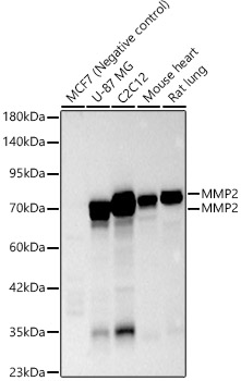 MMP2 Rabbit polyclonal antibody