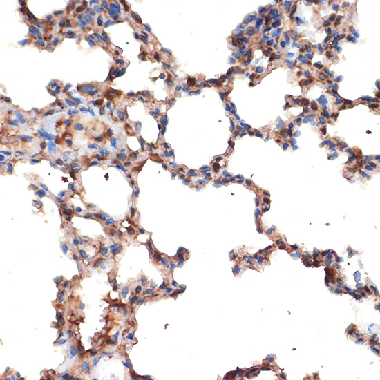 MMP2 Rabbit polyclonal antibody