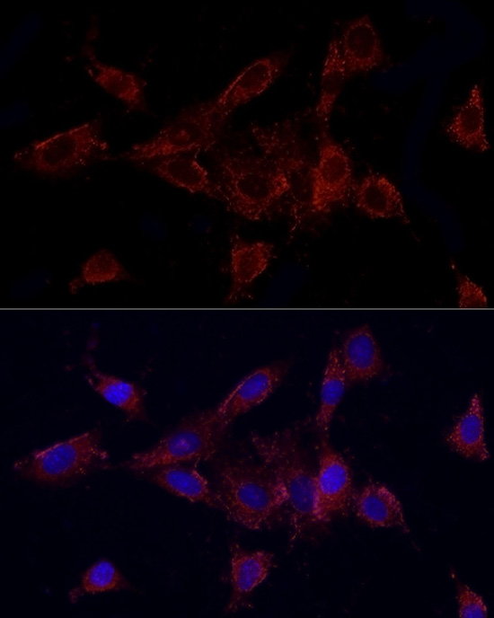MMP2 Rabbit polyclonal antibody