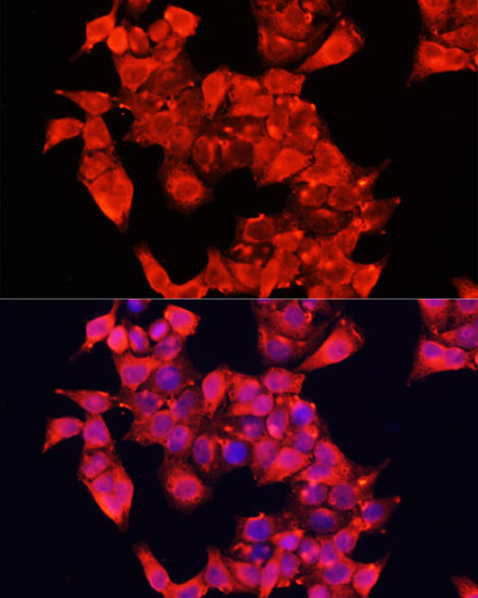 AOC1 Rabbit polyclonal antibody
