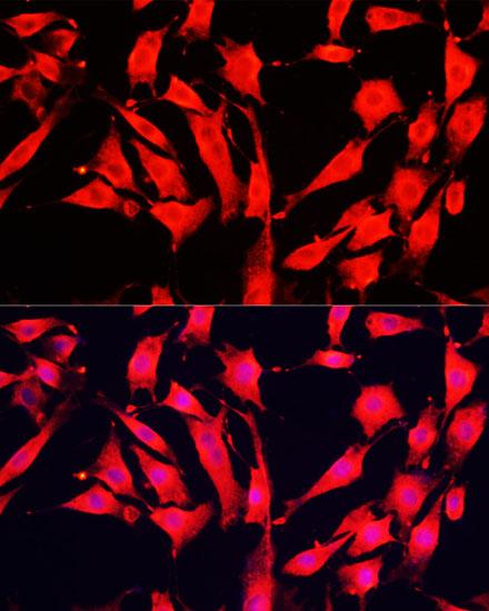 AOC1 Rabbit polyclonal antibody