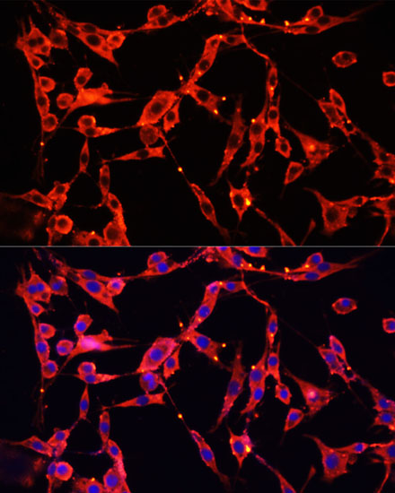 AOC1 Rabbit polyclonal antibody