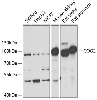 COG2 Rabbit polyclonal antibody