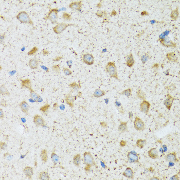 COG2 Rabbit polyclonal antibody