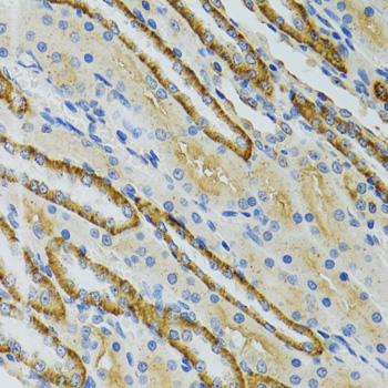 COG2 Rabbit polyclonal antibody