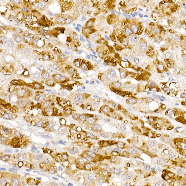 HSD17B13 Rabbit polyclonal antibody