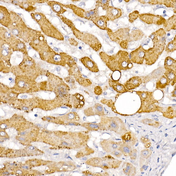 HSD17B13 Rabbit polyclonal antibody