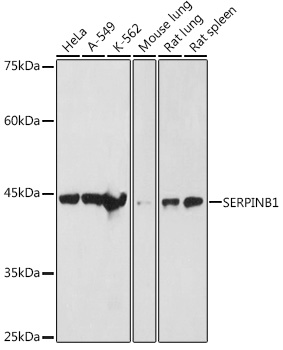 SERPINB1 Rabbit polyclonal antibody
