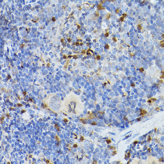 SERPINB1 Rabbit polyclonal antibody