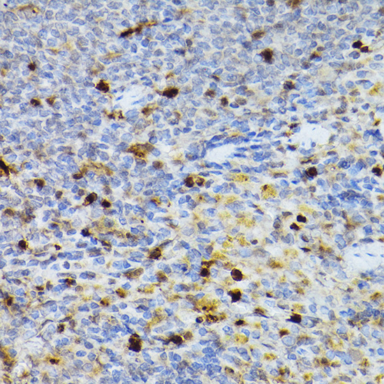 SERPINB1 Rabbit polyclonal antibody