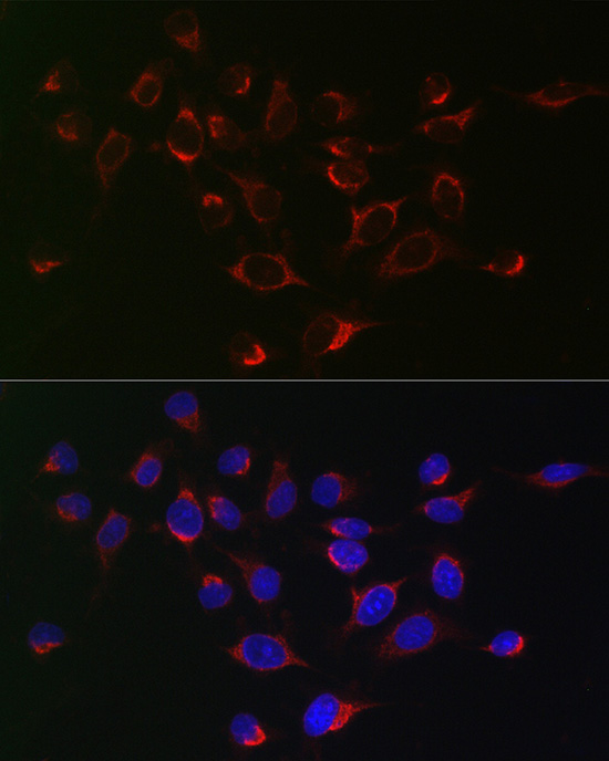 SERPINB1 Rabbit polyclonal antibody
