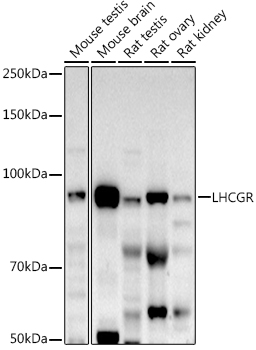 LHCGR Rabbit polyclonal antibody