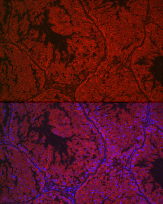 LHCGR Rabbit polyclonal antibody