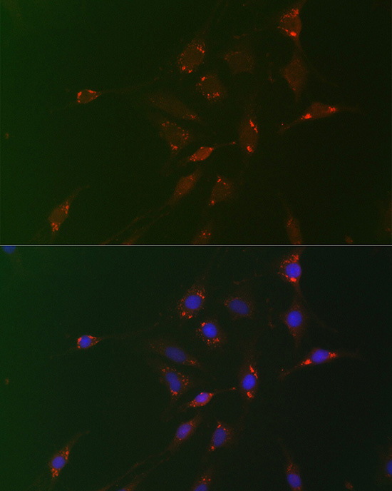 Perilipin-2 Rabbit polyclonal antibody