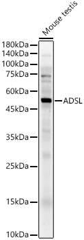 ADSL Rabbit polyclonal antibody