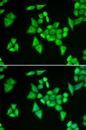 ADSL Rabbit polyclonal antibody