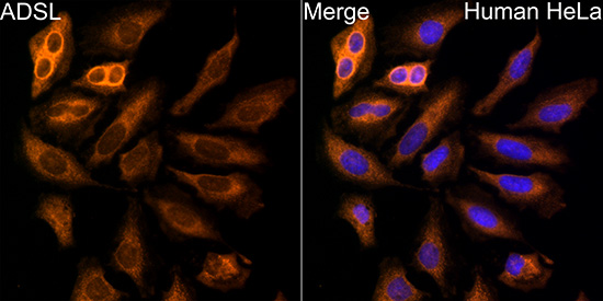 ADSL Rabbit polyclonal antibody