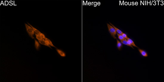 ADSL Rabbit polyclonal antibody
