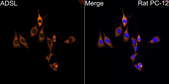 ADSL Rabbit polyclonal antibody