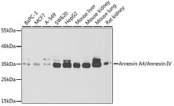 Western blot - Annexin A4/Annexin IV Rabbit pAb (A6280)