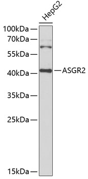 ASGR2 Rabbit polyclonal antibody