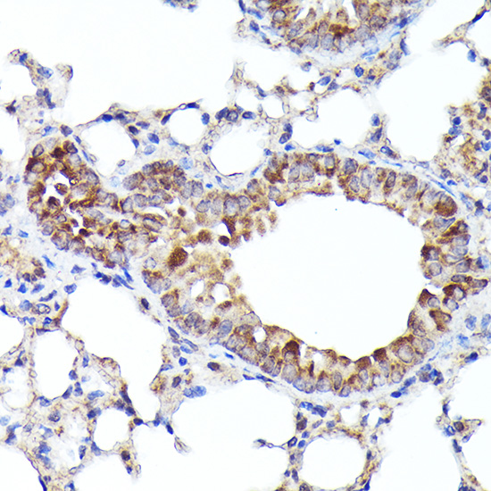 BNIP3L Rabbit polyclonal antibody