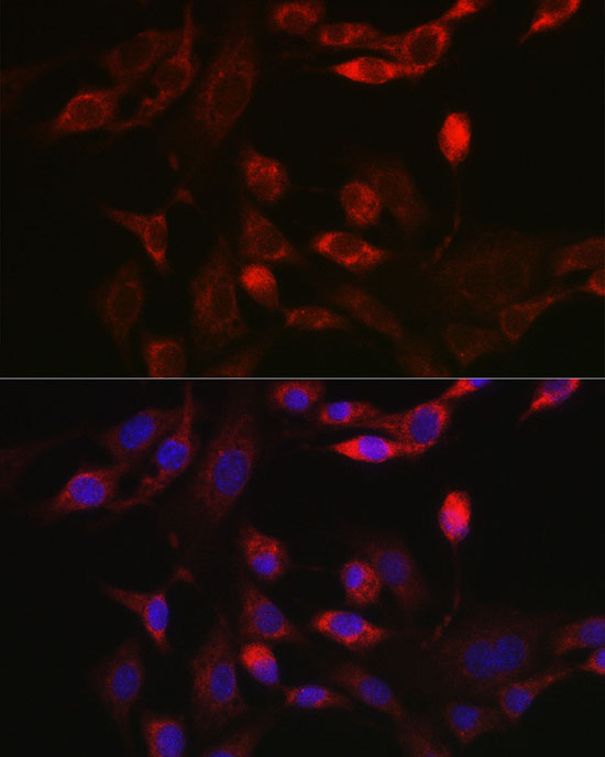 BNIP3L Rabbit polyclonal antibody