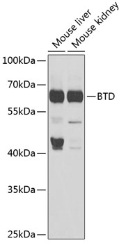 BTD Rabbit polyclonal antibody