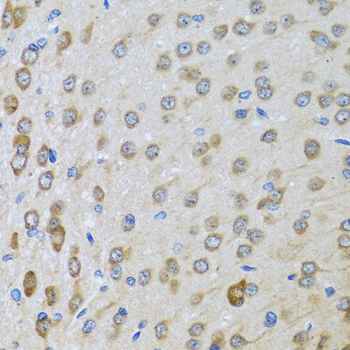 BTD Rabbit polyclonal antibody