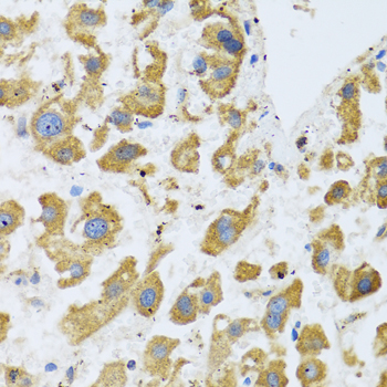 BTD Rabbit polyclonal antibody