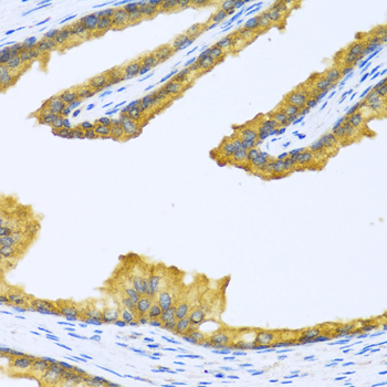 BTD Rabbit polyclonal antibody